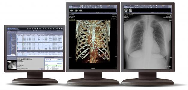 Mckesson mri viewer